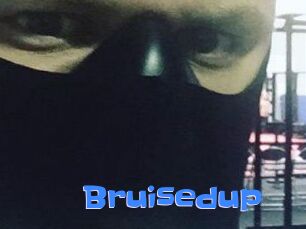 Bruisedup